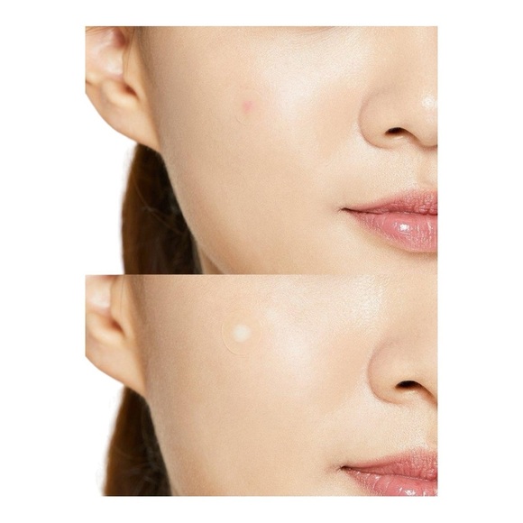 COSRX Acne Pimple Master Patch – 24 Patches - Picture 3 of 3